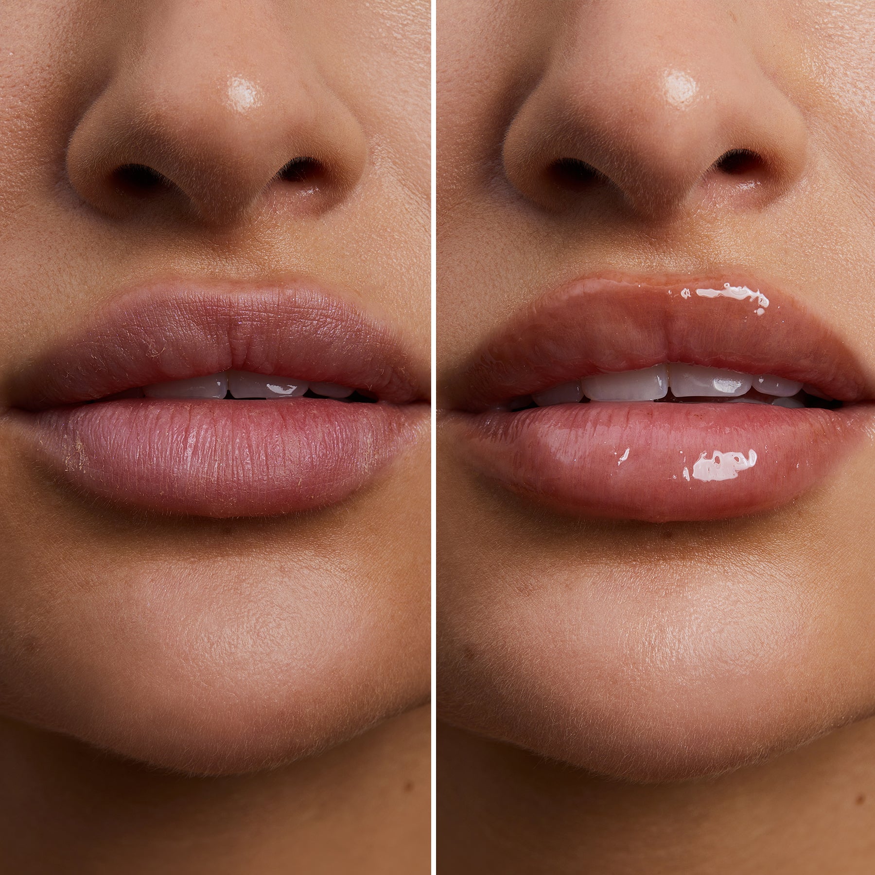 Sommer Lip Balm mit SPF Schutz
