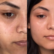 Eye Balm