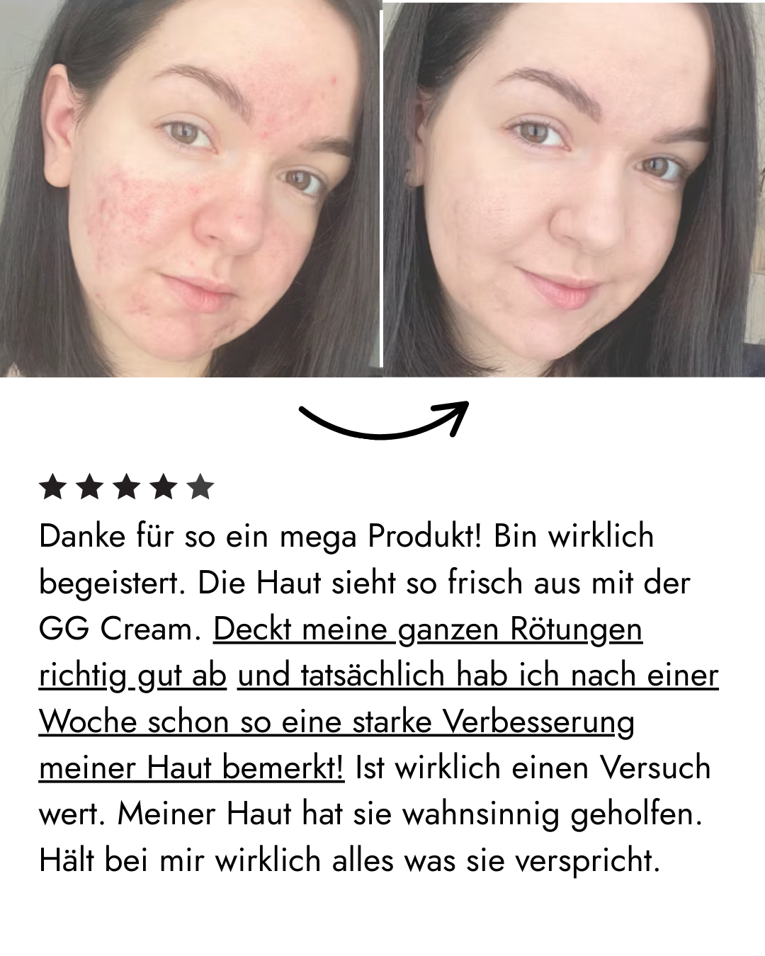 Filter Skin Set