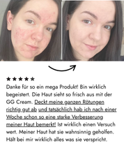 Filter Skin Set