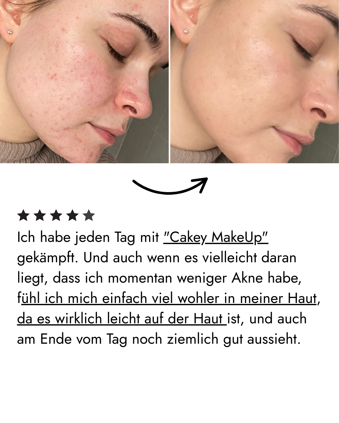 Filter Skin Set