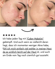 Filter Skin Set
