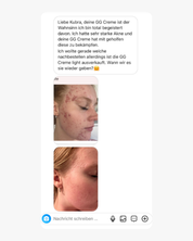 Filter Skin Set