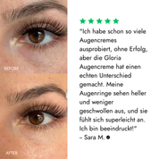 Filter Skin Set