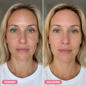Bio-Microneedling | Needless Shot Soft (+ gratis Milky Toner!)