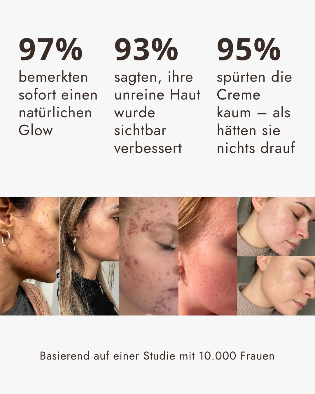 Filter Skin Set